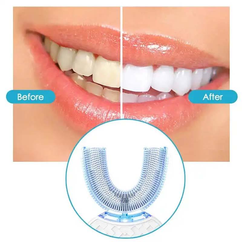 Bright Clean - Whitening Automatic Toothbrush