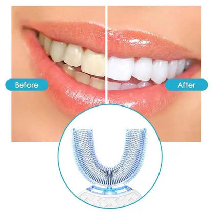 Bright Clean - Whitening Automatic Toothbrush